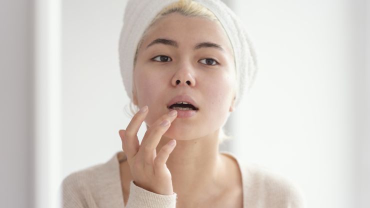 Cara Merawat Bibir Kering dengan Bahan Alami