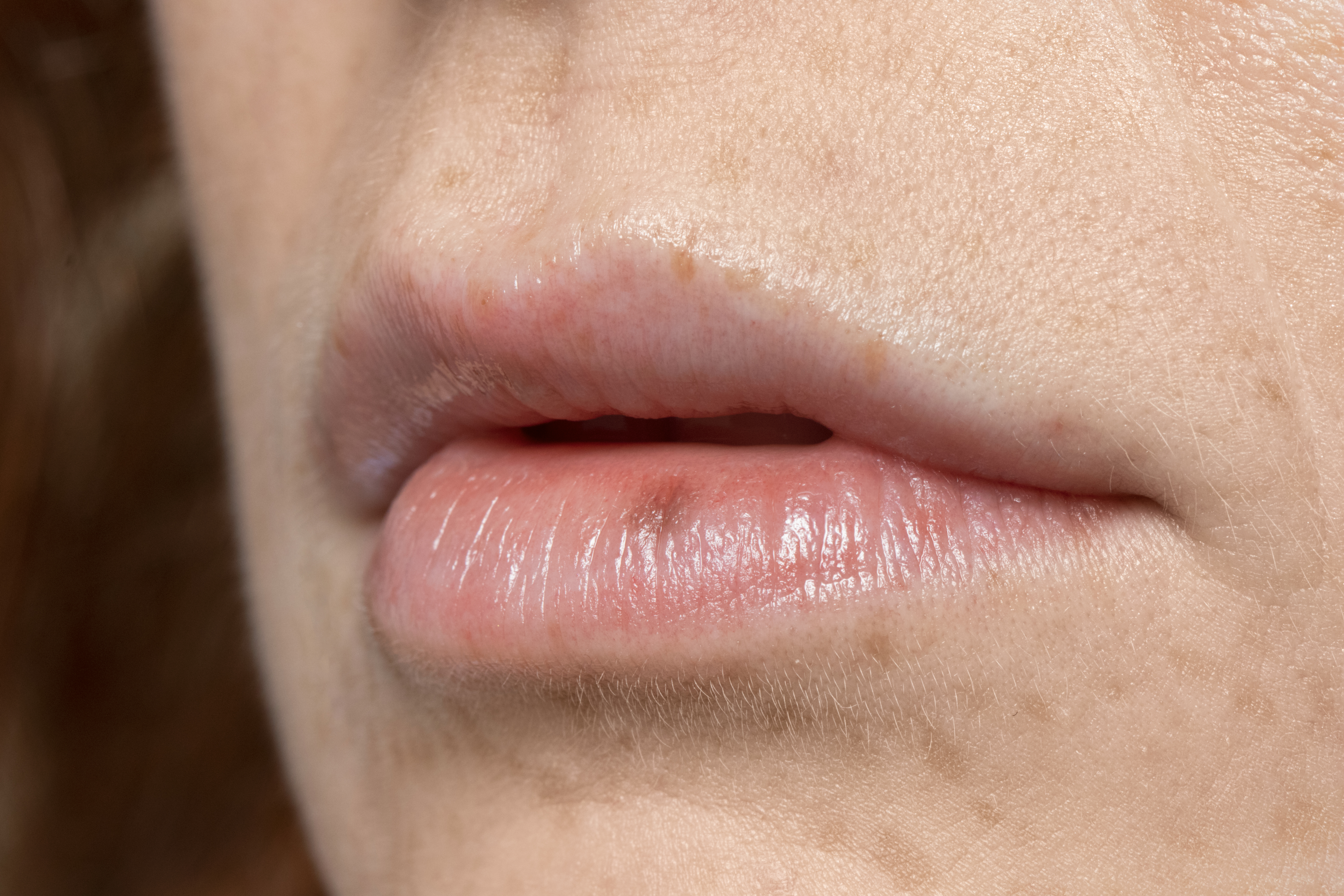 Bibir Kering? Temukan Penyebabnya dan Cara Mudah Mengatasinya