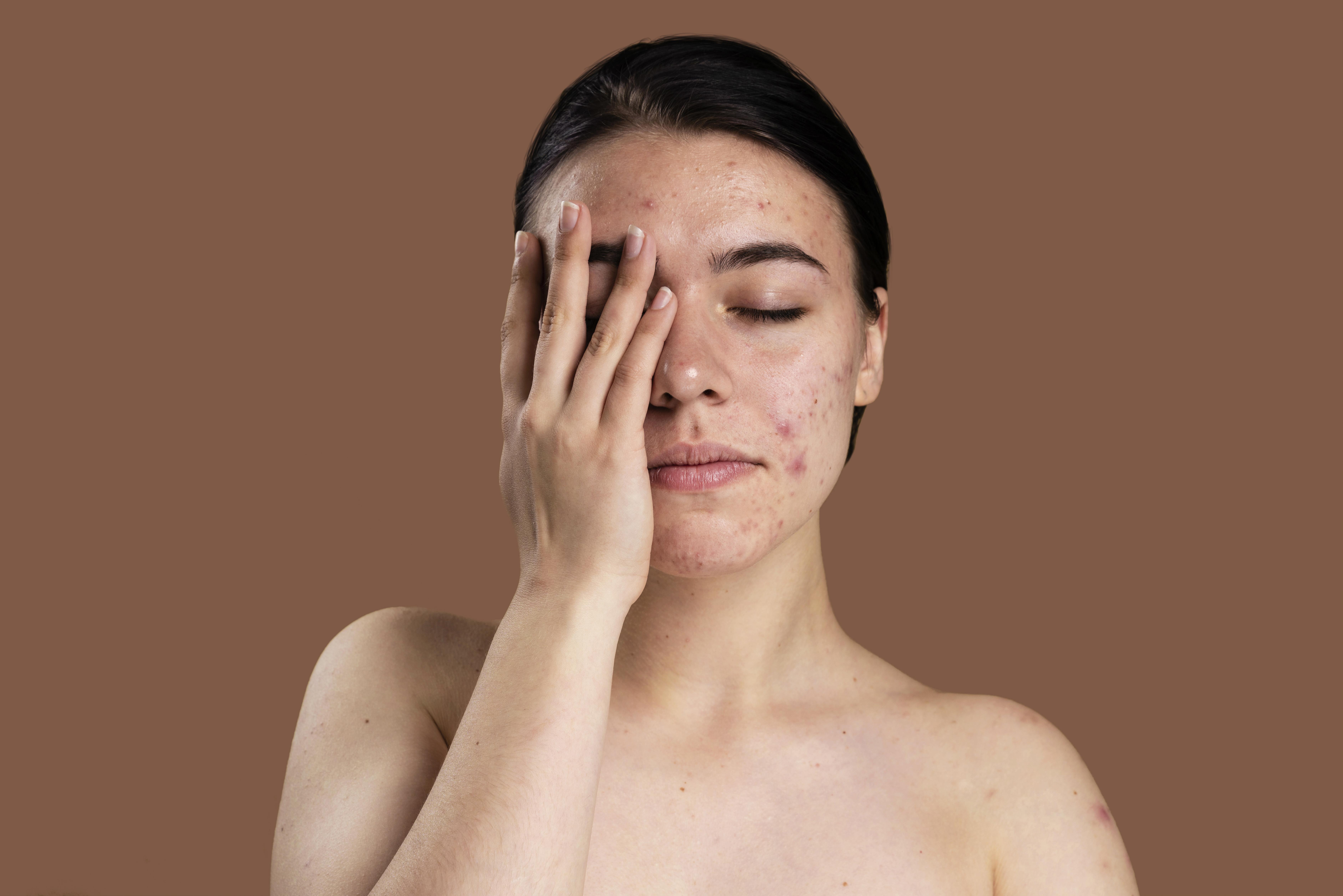 Waspada Efek Samping Retinol pada Wajah!